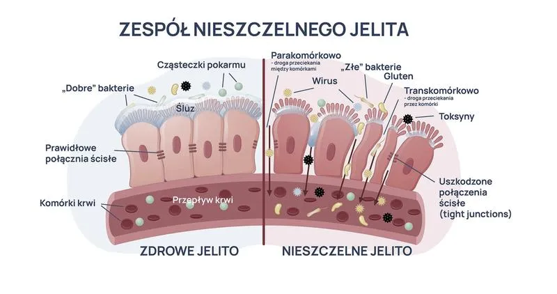 Probiotyki i prebiotyki